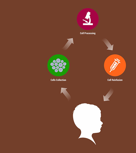 cell therapy Fo Autism, Autism Treatment