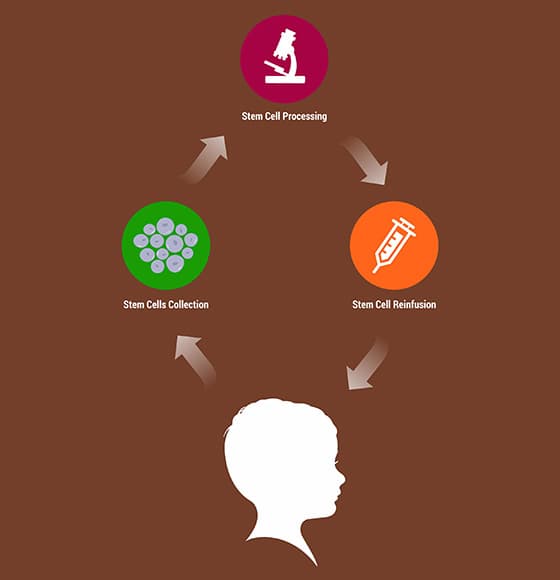cell therapy Fo Autism, Autism Treatment