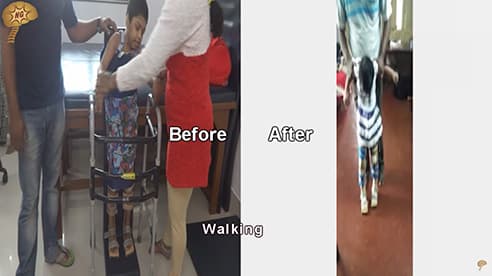P Akshaya, cell therapy Success Story, Neurogenbsi Patients